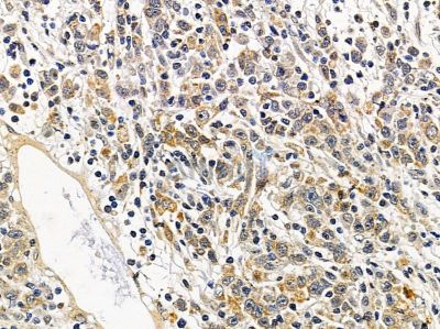 Валидация Affinity DF14498 - 10484