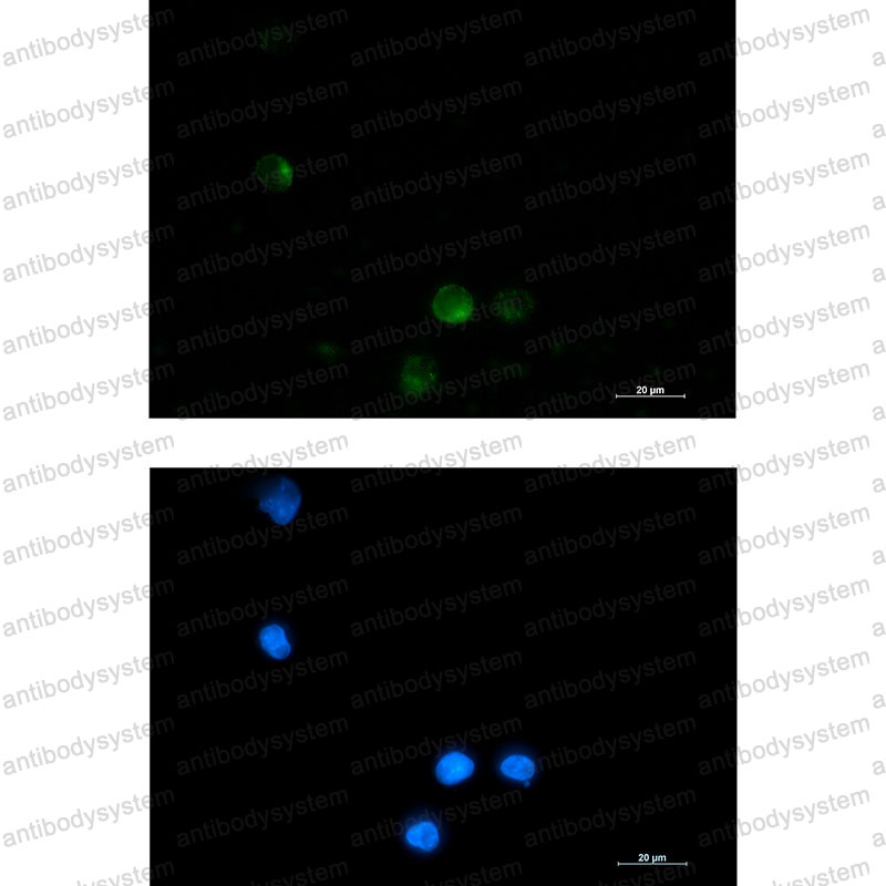 Валидация IF - AntibodySystem RHN66201