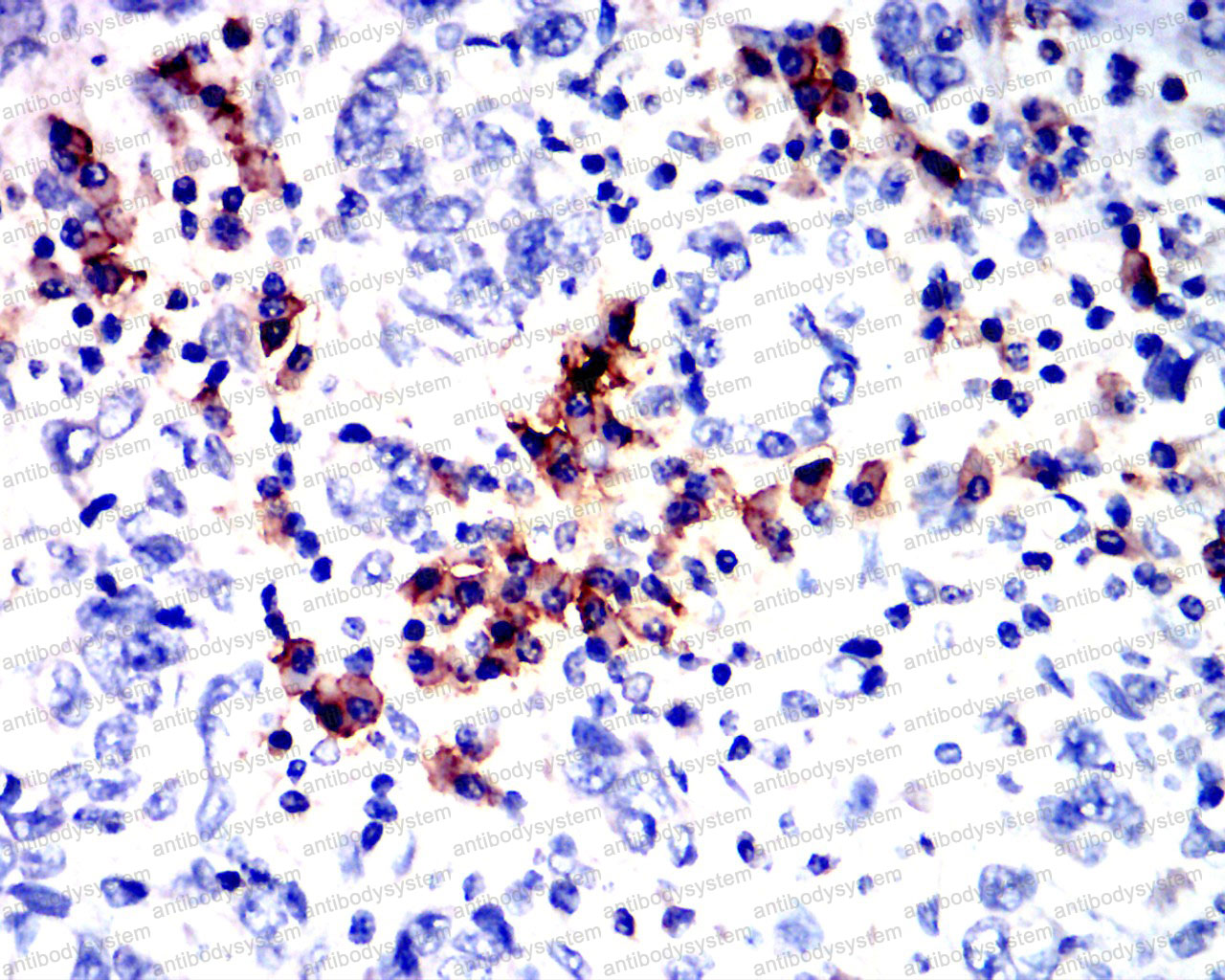 Валидация AntibodySystem RHD80809