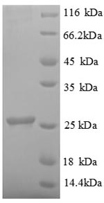 SDS-PAGE