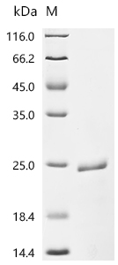 SDS-PAGE