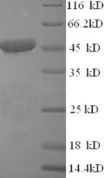 SDS-PAGE