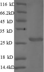 SDS-PAGE