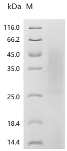 SDS-PAGE
