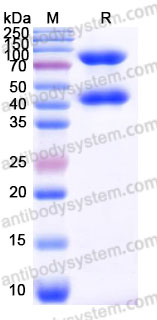 AHH37101, SDS-PAGE