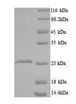 SDS-PAGE
