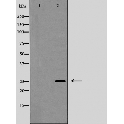 Валидация Affinity AF5116 - 2479