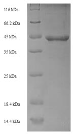 SDS-PAGE