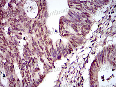 Валидация AntibodySystem RHP00301