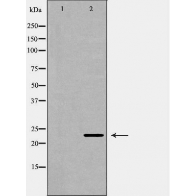 Валидация Affinity DF6333 - 17665
