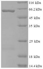 SDS-PAGE