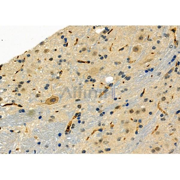 Валидация Affinity DF6017 - 17238