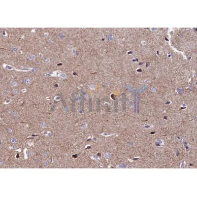 Валидация Affinity AF6493 - 3826