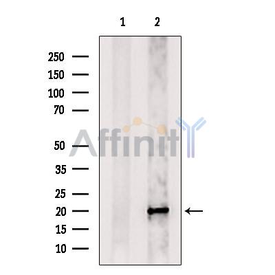 Валидация Affinity DF10233 - 5811