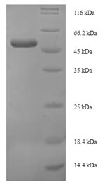 SDS-PAGE