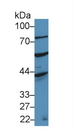 9761
