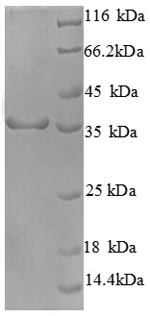 SDS-PAGE