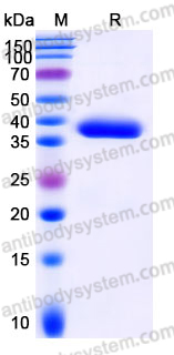 EHJ97701, SDS-PAGE