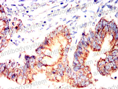Валидация AntibodySystem RHN06802 (3792)