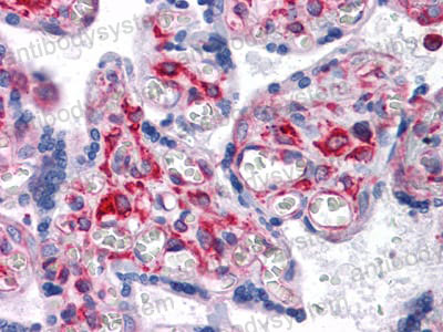 Валидация AntibodySystem RHD33104 (1496)