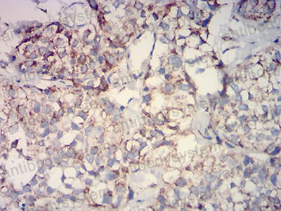 Валидация AntibodySystem RHE60802