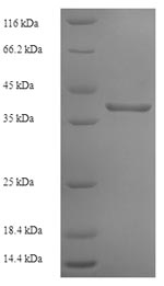 SDS-PAGE