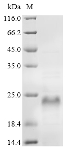 SDS-PAGE