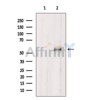 Валидация Affinity AF5380 - 3007