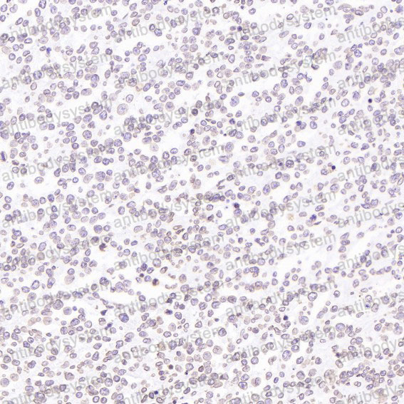 Валидация AntibodySystem RHD40901 (1567)