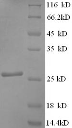 SDS-PAGE