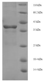 SDS-PAGE