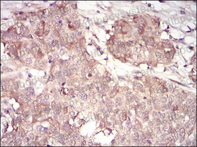 Валидация AntibodySystem RHD38205