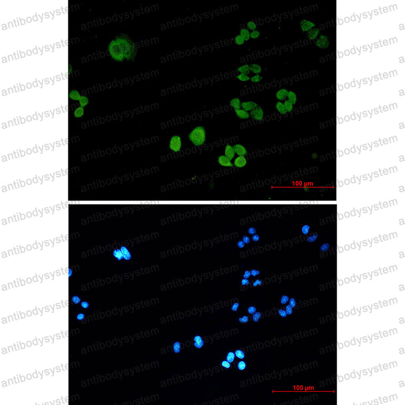 Валидация IF - AntibodySystem RHN76601