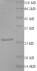 SDS-PAGE
