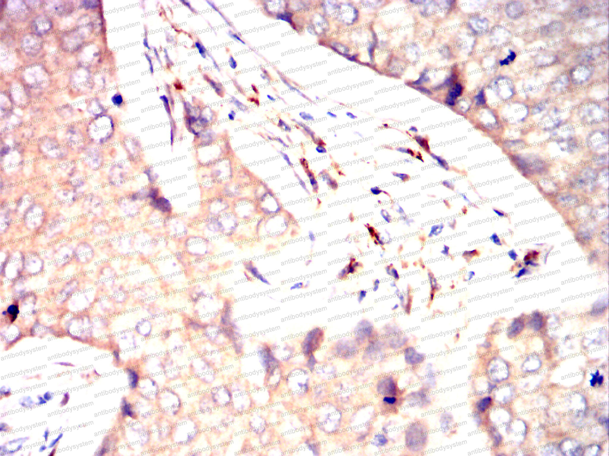 Валидация AntibodySystem RHD11501 (1339)