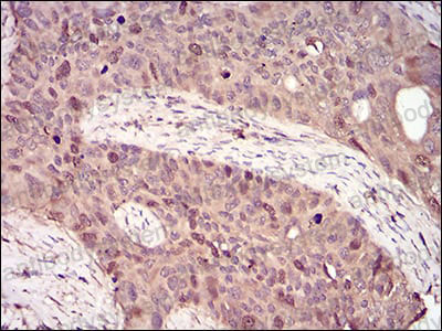 Валидация AntibodySystem RHD38205 (1544)