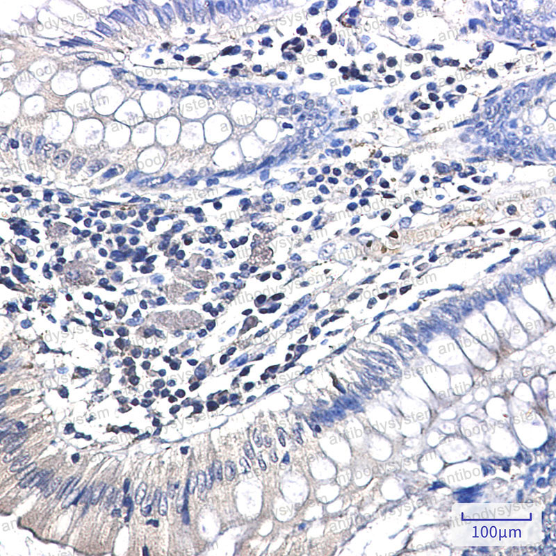 Валидация AntibodySystem RHC59204