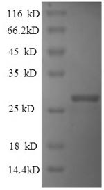 SDS-PAGE