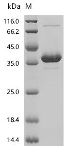 SDS-PAGE