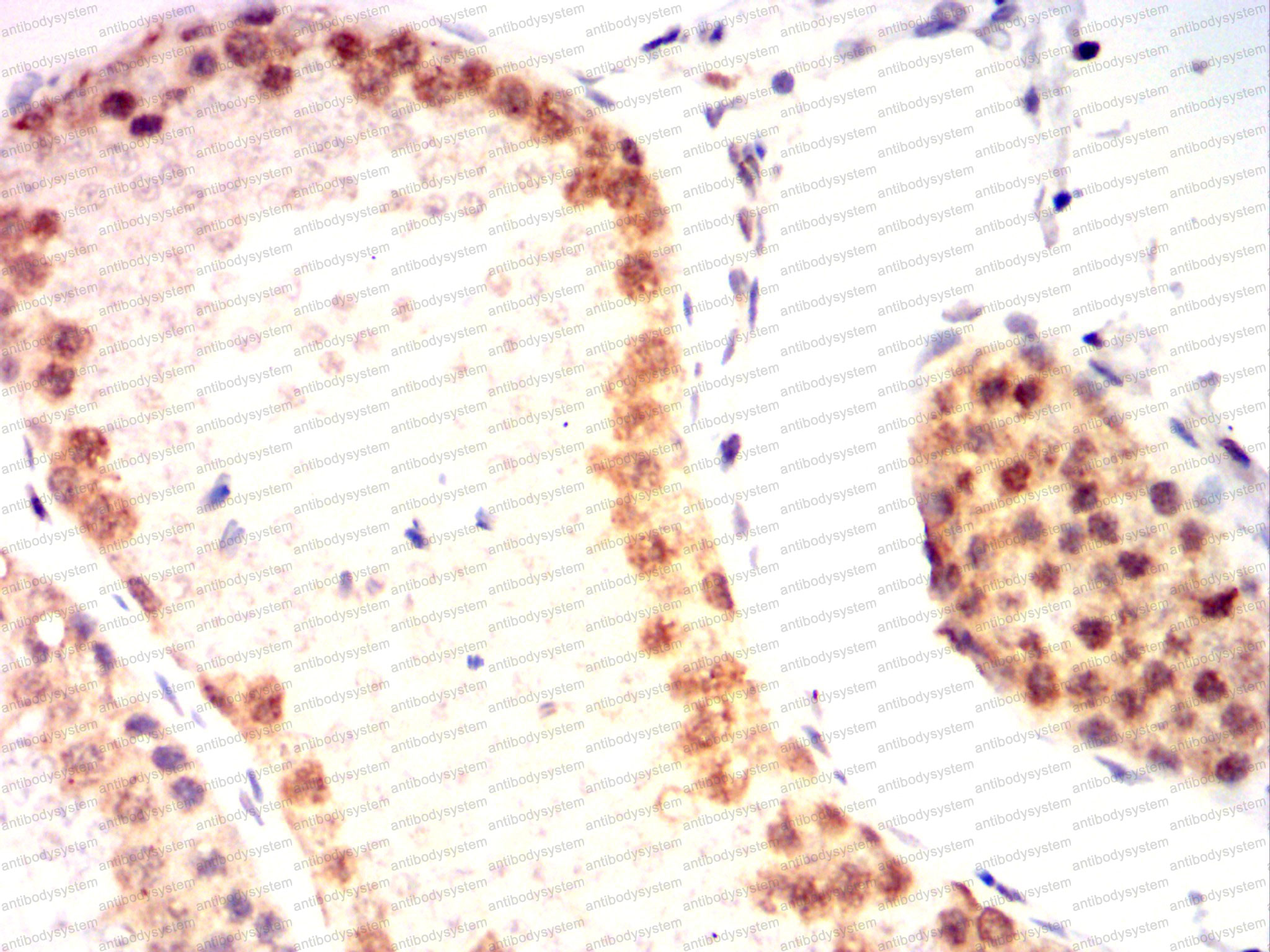 Валидация AntibodySystem RHG90002