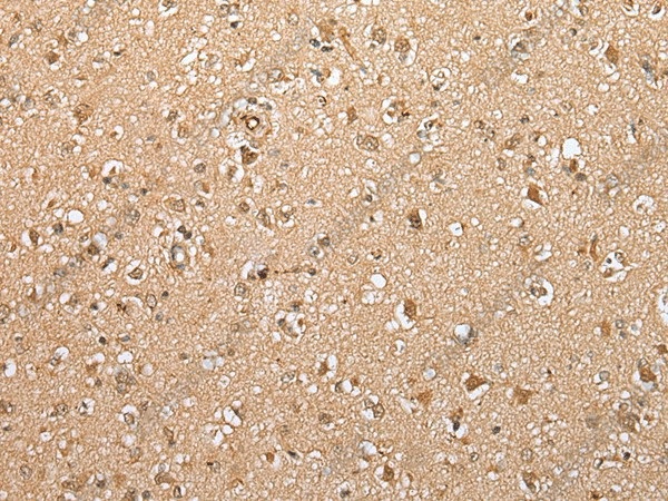 Иммуногистохимия, ATXN7L3, ткань мозга человека