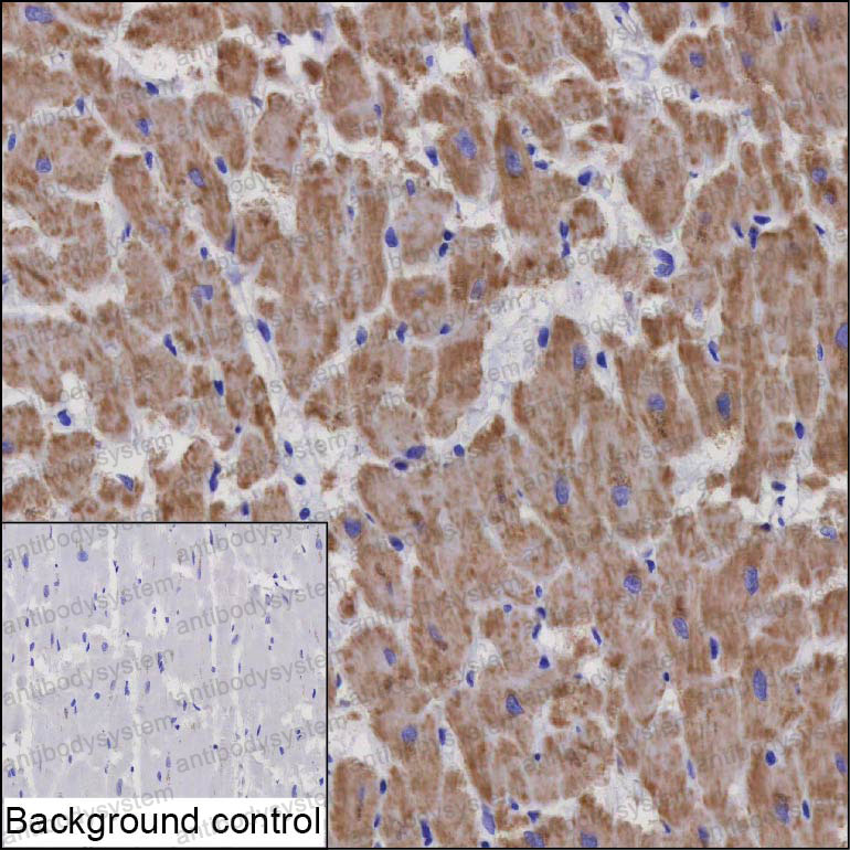 Валидация AntibodySystem RHB55302