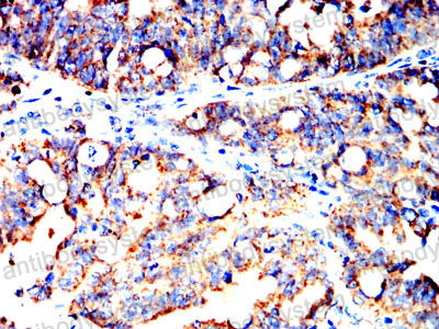 Валидация AntibodySystem RHE23205