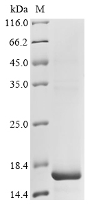 SDS-PAGE