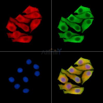 Валидация Affinity DF14310 - 10201