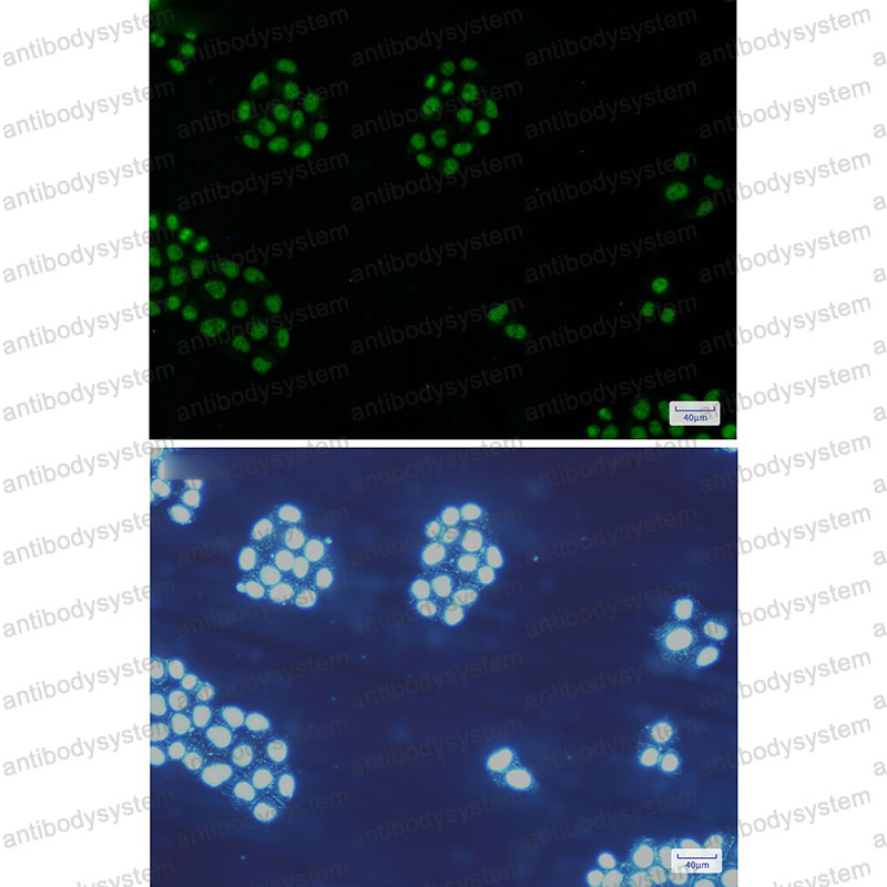 Валидация IF - AntibodySystem RHE04301