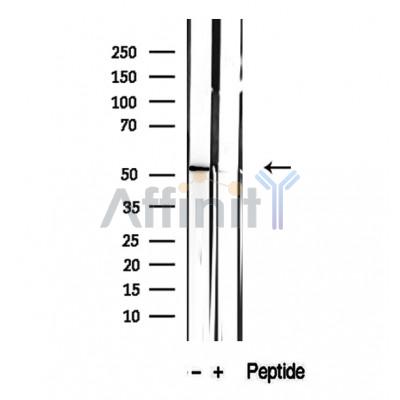 Валидация Affinity DF12360 - 6804