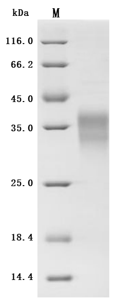 SDS-PAGE