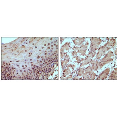 Валидация Affinity BF0614 - 5326