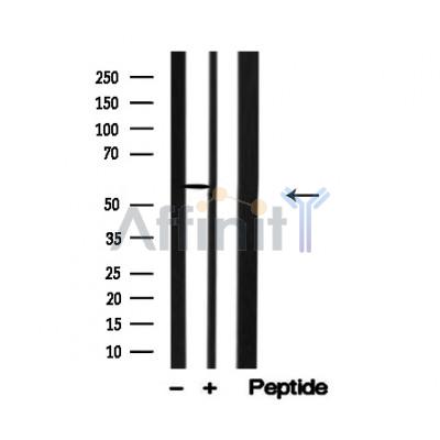 Валидация Affinity AF4778 - 2398